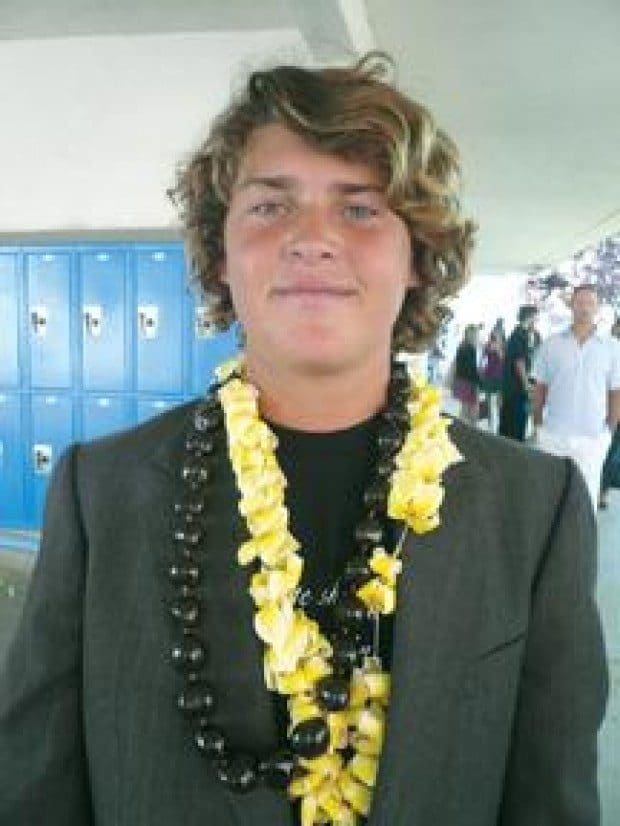 Surf contest to benefit young surfer with rare genetic disease