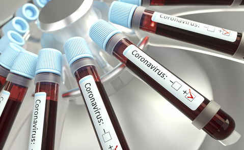 County Public Health Department Confirms Local Patient Being Tested for 'Coronavirus' COVID-19