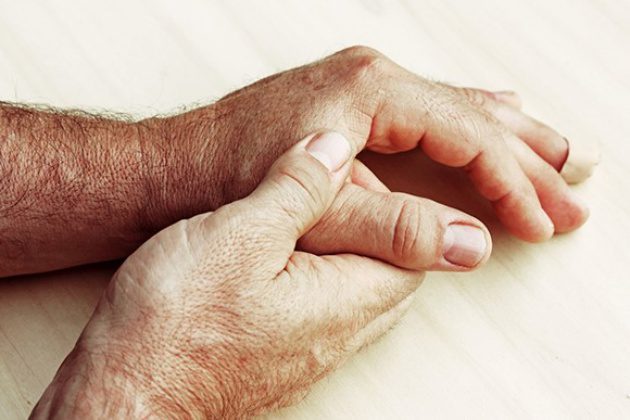 What you need to know to keep arthritis at bay